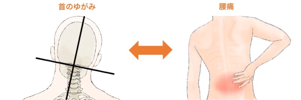 首の歪みと腰痛の因果関係