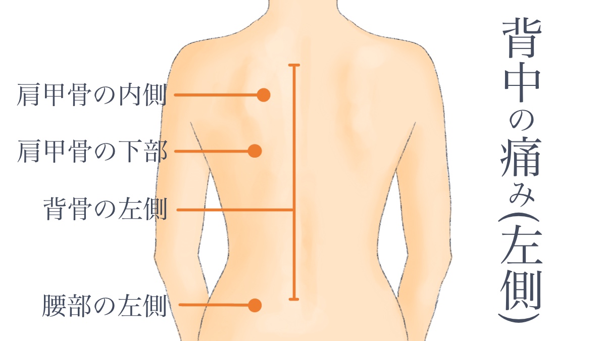 頻繁な背中の痛みは背中の問題の警告である可能性があります